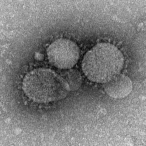 WHO was reported about 139 cases of  deadly MERS-Cov disease