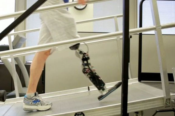 New Prosthetic Man Controls Bionic Leg with Thoughts